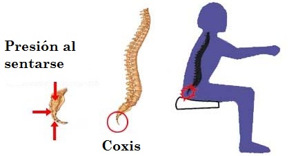 como quitar el dolor de coxis por caida